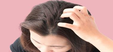 Ketahui Penyebab dan Cara Mengatasi Kulit Kepala Gatal